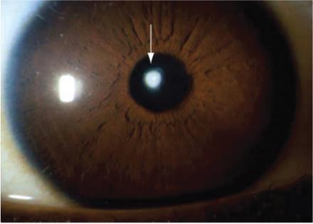 QB رومک جلد 3- جهت بازبینی